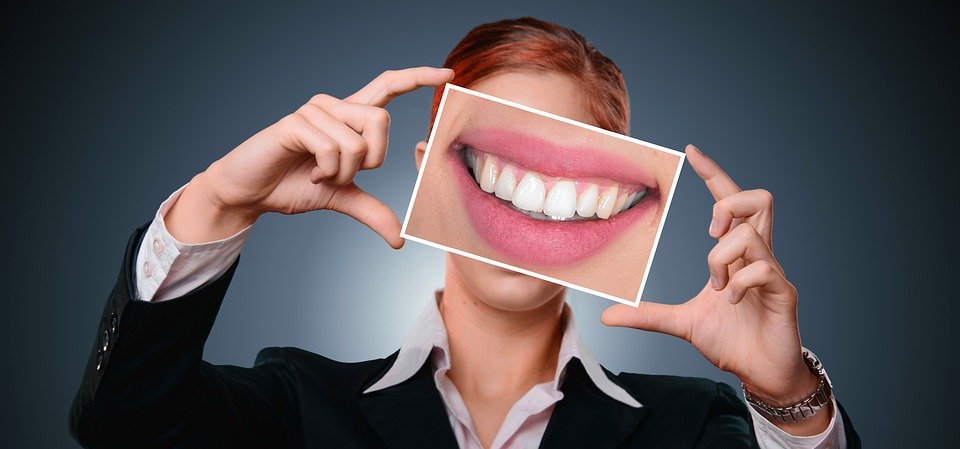 Blanchiment dentaire Nyon : ce qu’il faut pour avoir de belles dents